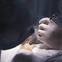 Sem escolha na infância, homens reavaliam a circuncisão e iniciam movimento para recuperar o prepúcio e sua identidade - Portal Giro 10