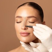 Rinoplastia associa correção estética e função respiratória - DINO