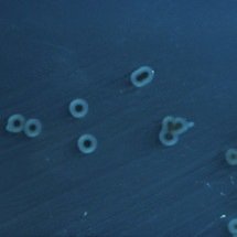 Infecção alimentar: estudo revela 45 novas toxinas produzidas por bactérias - CDC/Wikimedia Commons