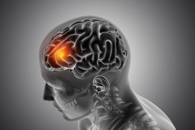 As chances de infarto crescem 36% quando problemas bucais são negligenciados -  (crédito: kjpargeter/Magnific)