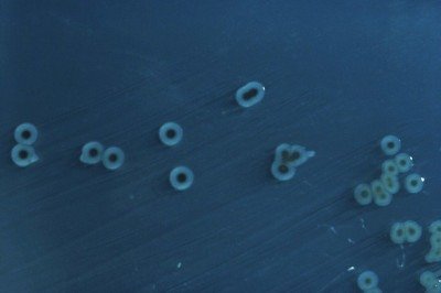 Dos 128 tipos toxina identificados, 45 são muito diferentes das conhecidas ou nunca haviam sido descritos pela ciência -  (crédito: CDC/Wikimedia Commons)