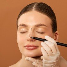 Rinoplastia alia estética e função respiratória - DINO