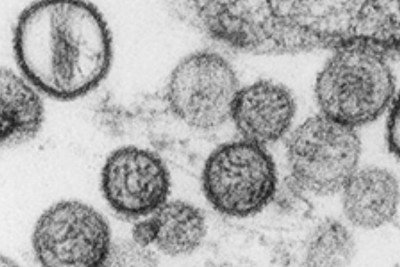 A hantavirose &eacute; uma infec&ccedil;&atilde;o viral grave, cujo agente transmissor pode ser observado em micrografias. -  (crédito: Divulga&ccedil;&atilde;o/ Minist&eacute;rio da Sa&uacute;de)