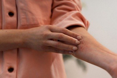 Desejo constante de cutucar a pele pode deixá-la avermelhada, sensível, propícia a infecções e até com sangramentos -  (crédito: Magnific)