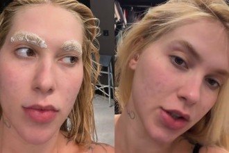Virginia Fonseca clareia sobrancelhas e especialista alerta para riscos