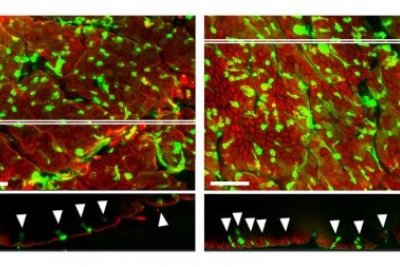 À esquerda, parede intestinal de animais cuja microbiota foi depletada com uso de antibióticos; à direita, parede intestinal de animais que mantiveram população de bactérias integra -  (crédito: Vinícius Dias Nirello/IB Unicamp)