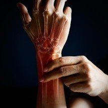 Reumatologia investiga e orienta tratamento de dor crônica - DINO