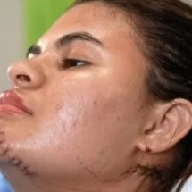 Jovem com mão decepada finge morte e escapa de ataque do namorado - Reprodução / TV Globo