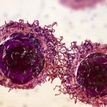 Novo tratamento com pembrolizumabe pode manter pacientes com câncer colorretal livres da doença por anos - Portal Giro 10