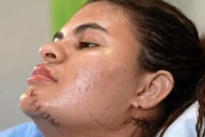 Ana Clara teve inúmeros ferimentos graves nas pernas, braços, costas, rosto e pescoço  -  (crédito: Reprodução / TV Globo)