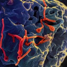 São Paulo investiga caso suspeito de ebola em homem de 37 anos - Wikimedia Commons