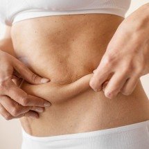 Tecnologia melhora retração da pele após lipoaspiração - DINO