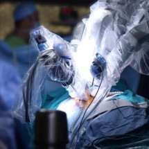 Alta tecnologia na saúde pública: como a cirurgia robótica está transformando o SUS - Portal Giro 10