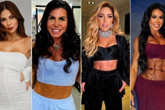 Veja as famosas que fizeram harmonização íntima e os motivos surpreendentes