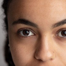 Você tem olheiras? Especialista orienta como cuidar em cada caso - FreePik/Magnific