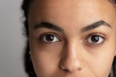 A pigmentação é percebida pela cor da pele, e não muda se esticamos levemente a região -  (crédito: FreePik/Magnific)