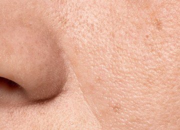 A apar&ecirc;ncia dos poros dilatados, um desafio comum na pele, pode ser melhorada com a rotina de skincare correta. -  (crédito: FreePik)