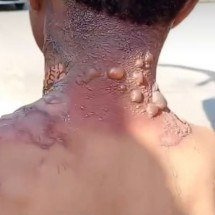 Grávida mantém namorado em cárcere, arranca piercing e o queima em MG - Reprodução/Redes Sociais