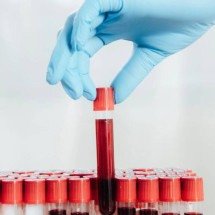 Pesquisa em psiquiatria molecular identifica sinais biológicos associados à depressão, mas diagnóstico por sangue ainda é futuro - Portal Giro 10