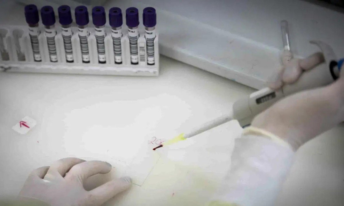 Testes para o vírus Ebola continuam em andamento em paciente internado em São Paulo - (crédito: Pablo Jacob/Governo de SP)