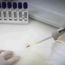 Paciente em SP com suspeita de ebola testa positivo para meningite -  Pablo Jacob/Governo de SP