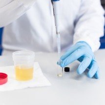 Novo exame analisa exposição hormonal feminina - DINO