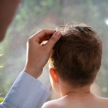 Cranioestenose: como identificar os sinais e quando se preocupar - FreePik/Magnific