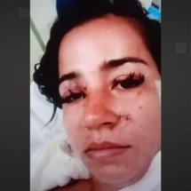 Jovem é esfaqueada 34 vezes em praça; ex-sogra é suspeita - Tupi