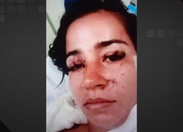 Jovem é esfaqueada 34 vezes na Praça Seca; ex-sogra é suspeita -  (crédito: Tupi)