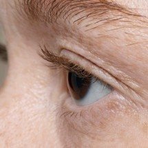 Cirurgias dermatológicas ganham destaque no tratamento do câncer de pele - FreePik/Magnific
