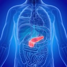 Estudo inédito mostra avanço histórico no tratamento do câncer de pâncreas metastático - Portal Giro 10