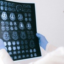 BrainAge: tecnologia indica a idade cerebral - DINO