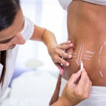 Lipo HD amplia possibilidades da definição corporal - DINO