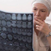 IA pode reduzir diagnóstico de câncer cerebral de 12 dias para 12 minutos - Portal Giro 10
