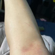 Adolescentes estupram amiga, de 17 anos, dentro na casa dela - Reprodu&ccedil;&atilde;o