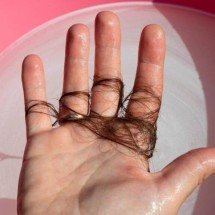 Alopecia: principais causas da queda de cabelo, sintomas mais comuns e tratamentos disponíveis para diferentes tipos da condição - Portal Giro 10