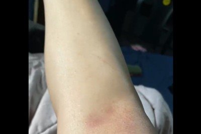V&iacute;tima ficou com hematomas ap&oacute;s a viol&ecirc;ncia sexual, constatados por exame de corpo de delito -  (crédito: Reprodu&ccedil;&atilde;o)