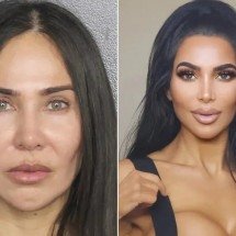 Brasileira é condenada nos EUA por morte de sósia de Kim Kardashian após procedimento estético - Redes Sociais 