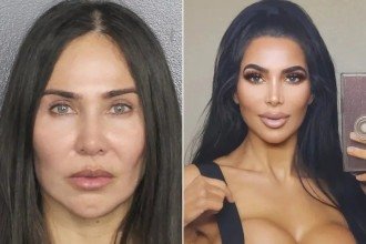 Brasileira é condenada nos EUA por morte de sósia de Kim Kardashian após procedimento estético