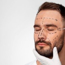 O fim do tabu: quais procedimentos os homens mais estão buscando? - FreePik/Magnific