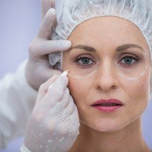 Cirurgia das pálpebras melhora aparência e visão - DINO
