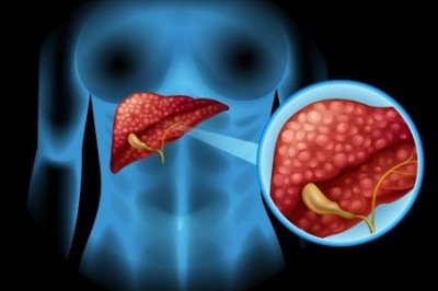 É no fígado que ocorre a gliconeogênese, quando o organismo fabrica glicose a partir de outras substâncias; experimentos com gatos e ratos alimentados com dietas hiperproteicas confirmaram a mesma capacidade elevada de produção hepática de glicose  -  (crédito: Brgfx/Magnific)