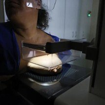 ANS defende que plano cubra mamografia digital sem restrição de idade