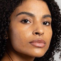 Mês de Conscientização da Acne incentiva cuidados especiais - DINO