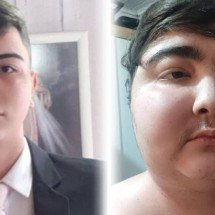 Tumor com menos de 1 centímetro fez adolescente ganhar 40 quilos em 6 meses - Divulgação/Hospital Pequeno Príncipe