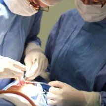Fissura labiopalatina demanda tratamento precoce e multidisciplinar - HRAC-USP/Divulgação
