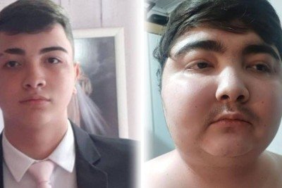 O tumor que afetou a saúde de Gustavo é essa pequena mancha vermelha dentro do pote de plático -  (crédito: Divulgação/Hospital Pequeno Príncipe)