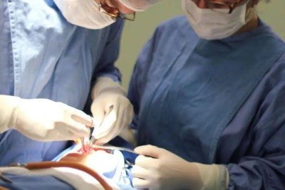 Fissura labiopalatina requer várias cirurgias e tratamento multidisciplinar para corrigir o problema -  (crédito: HRAC-USP/Divulgação)