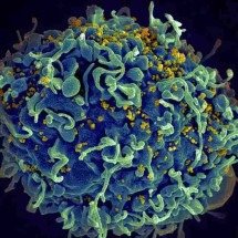 HIV pode deixar rastro no sistema nervoso mesmo com vírus controlado no sangue, indica estudo - NIH/Wikimedia Commons