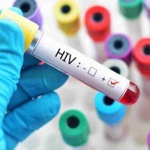 Saiba onde a epidemia de HIV tem crescimento mais rápido no mundo e o por que - PRess Serbia - Flickr
